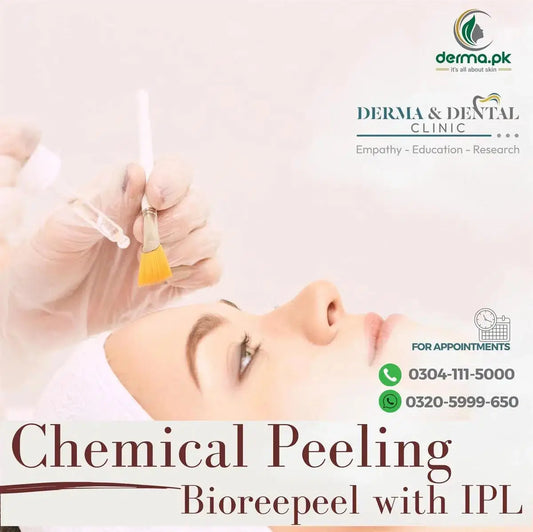 Enhance Your Skin with Chemical Peeling Bioreepeel and IPL - Derma & Dental Clinic