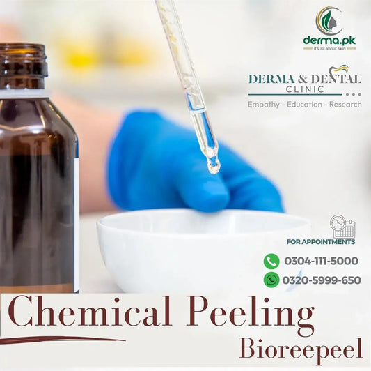 Revitalize Your Skin with Chemical Peeling Bioreepeel: Expert Dermatology at Derma & Dental Clinic